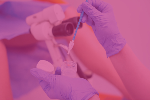 Image hover effect image